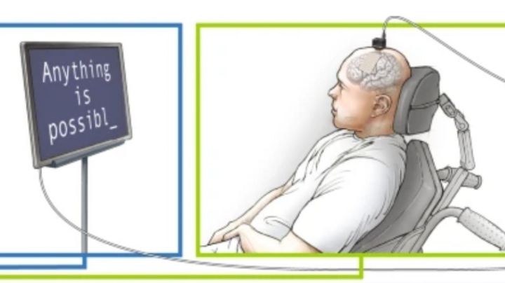 Avanza la tecnología de implantes cerebrales que pueden “leer” los pensamientos