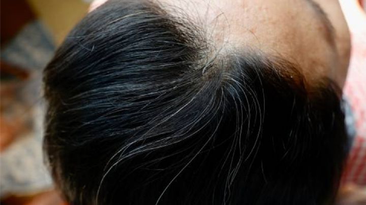 ¿Cómo desaparecer las canas de forma natural utilizando hojas de nogal?