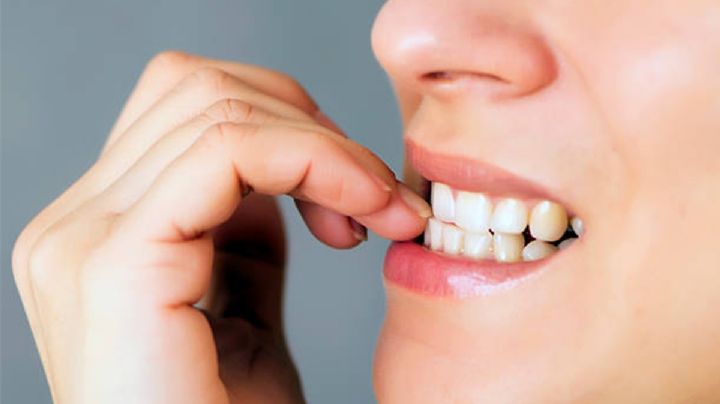 ¿Cuáles son las consecuencias de morderse las uñas?